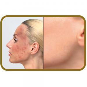 Cover make-up “Dermacol” 