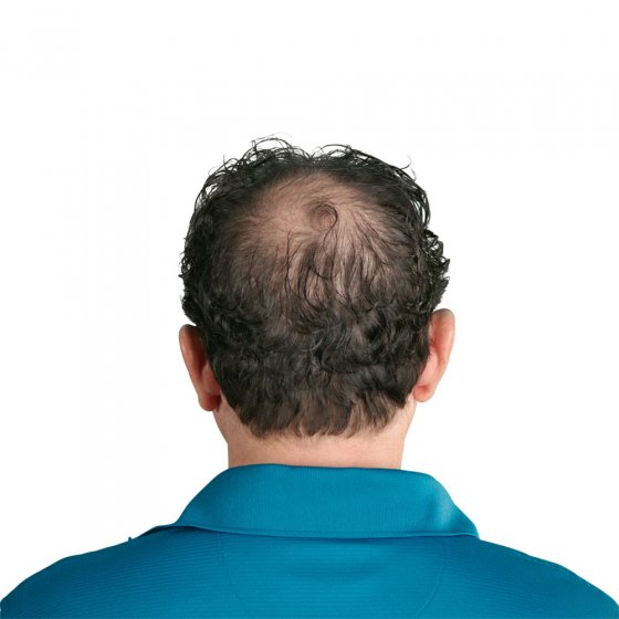 Lotion capillaire antichute 