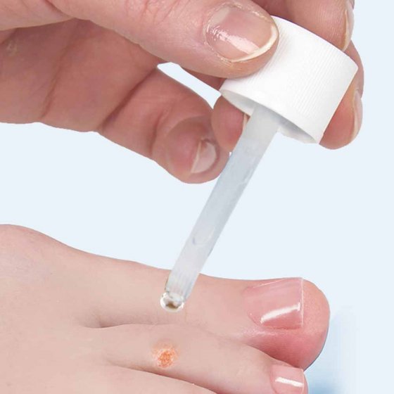 Teinture anti-verrues 