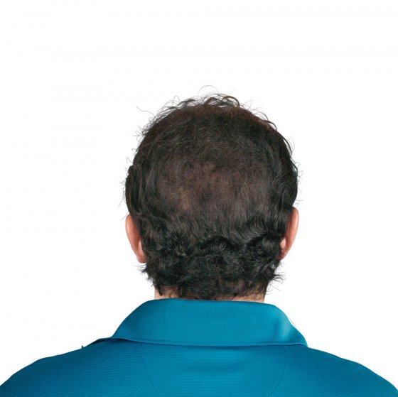 Lotion capillaire antichute 