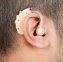 Appareil auditif - 3