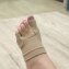 Séparateur d'orteils pour hallux valgus - 4