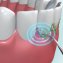 Système de nettoyage dentaire  "Dental Pic Sonic" - 4