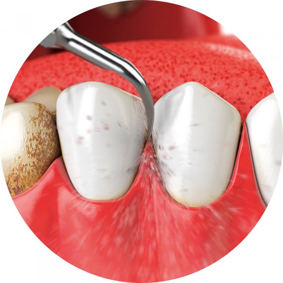 Brosse à dent sonique électrique 