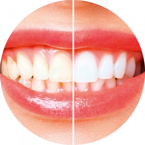 Brosse à dent sonique électrique 