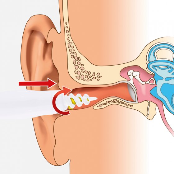 Nettoyeur d'oreille Easy Clean 
