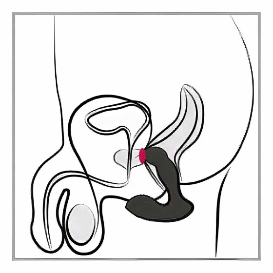 Prostaatvibrator 